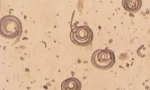 Što je trichinella spiralis