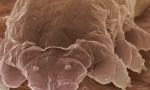 Mite demodex i značajke njegovih životnih sredstava