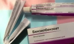 Indikacije i postupak liječenja benzilbenzoatom