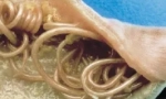 Unutarnji paraziti (endoparaziji)