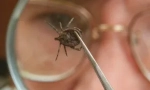 Muškarac infekcija s encefalitisom