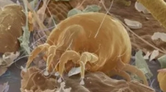 Alergija na prašinu