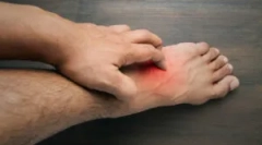 Alergija da ugrizu cvijet u čovjeku