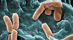 Koje eukariote se razlikuju od prokariota?