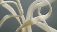 Kako opasne crve vrpce u ljudima i njihovim simptomima