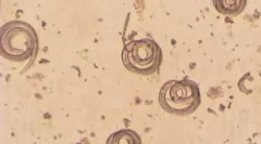 Što je trichinella spiralis