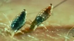 Što uši uboji izgledaju?