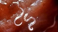 Kako se malarijalni plazmodium živi i razvija