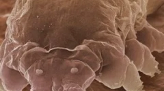 Mite demodex i značajke njegovih životnih sredstava