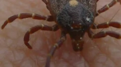 Maksimalna monocitarna erlihioza