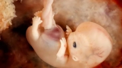 Ontogeneza i inherentni uzorci