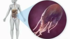 Snaga i prehrana s giardiasis