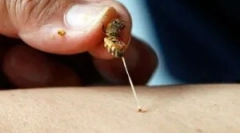 Sredstva iz ujedinjenih uma