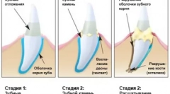 Domaći predator care - čišćenje cattick