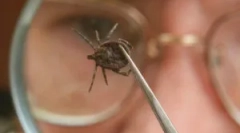 Muškarac infekcija s encefalitisom